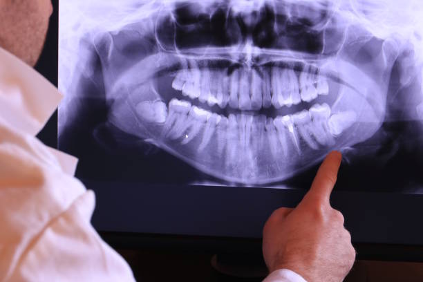 Best Emergency Dentist for Knocked-Out Tooth in San Pasqual, CA